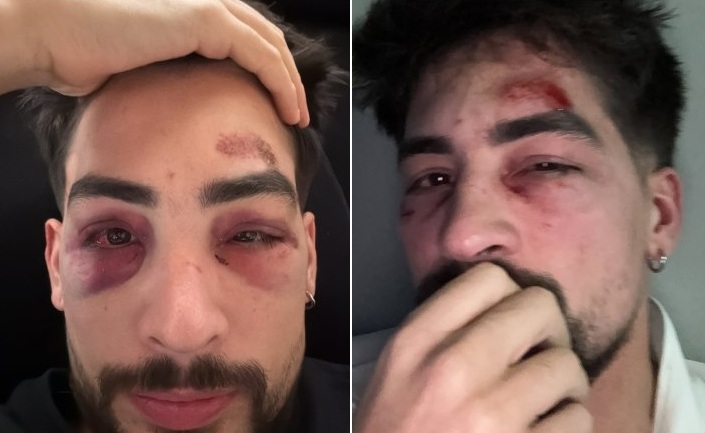 Empresário gay Donizete Oliveira é agredido no karaokê Siga La Vaca