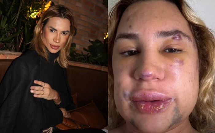 Influenciador de moda Junior Dutra morre