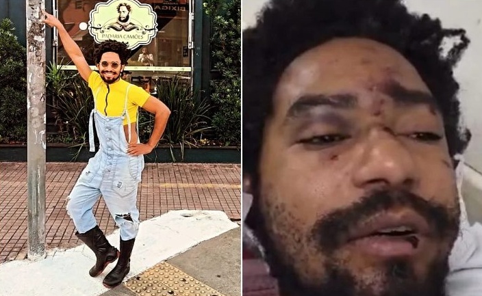 Ator vestido de drag queen denuncia ter sido espancado por homofobia