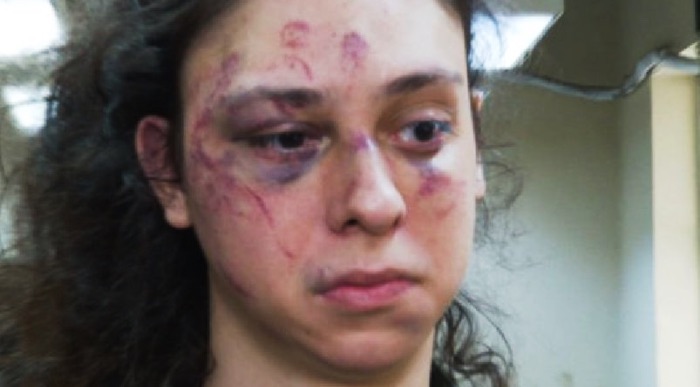 Ator é espancado por homem que conheceu em balada