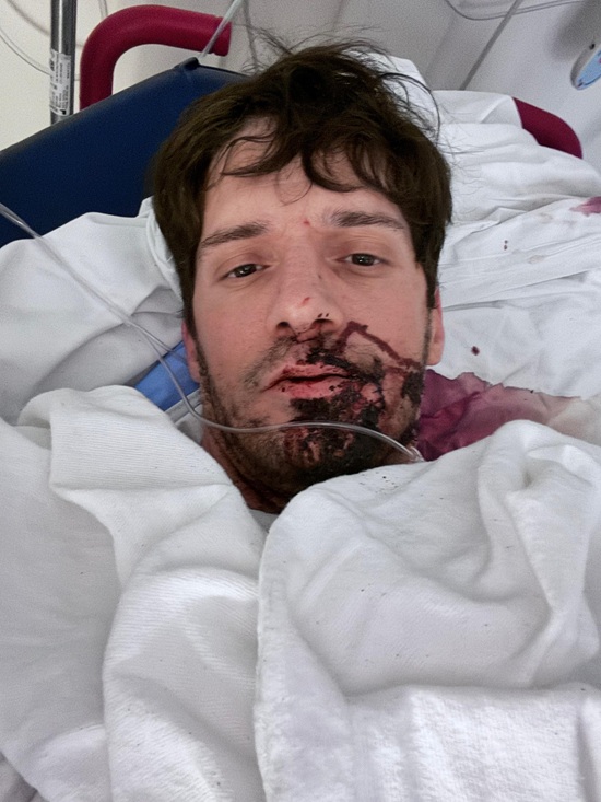 Ty Roderick: ator de pornô gay é esfaqueado nos EUA