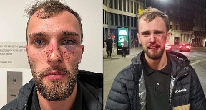 Homem é espancado por 5 seguranças de boate gay na Inglaterra