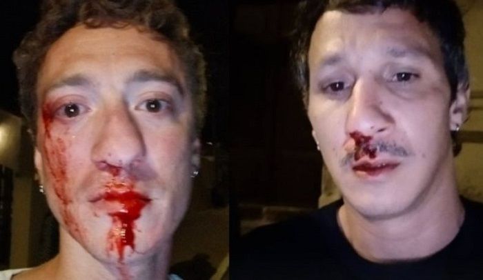 Casal gay apanha de 20 homens em frente a 60 pessoas que nada fazem