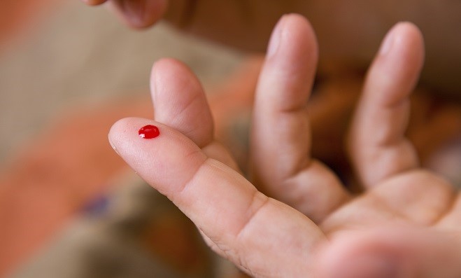 5 dicas para você que for fazer teste de HIV comprado em farmácia
